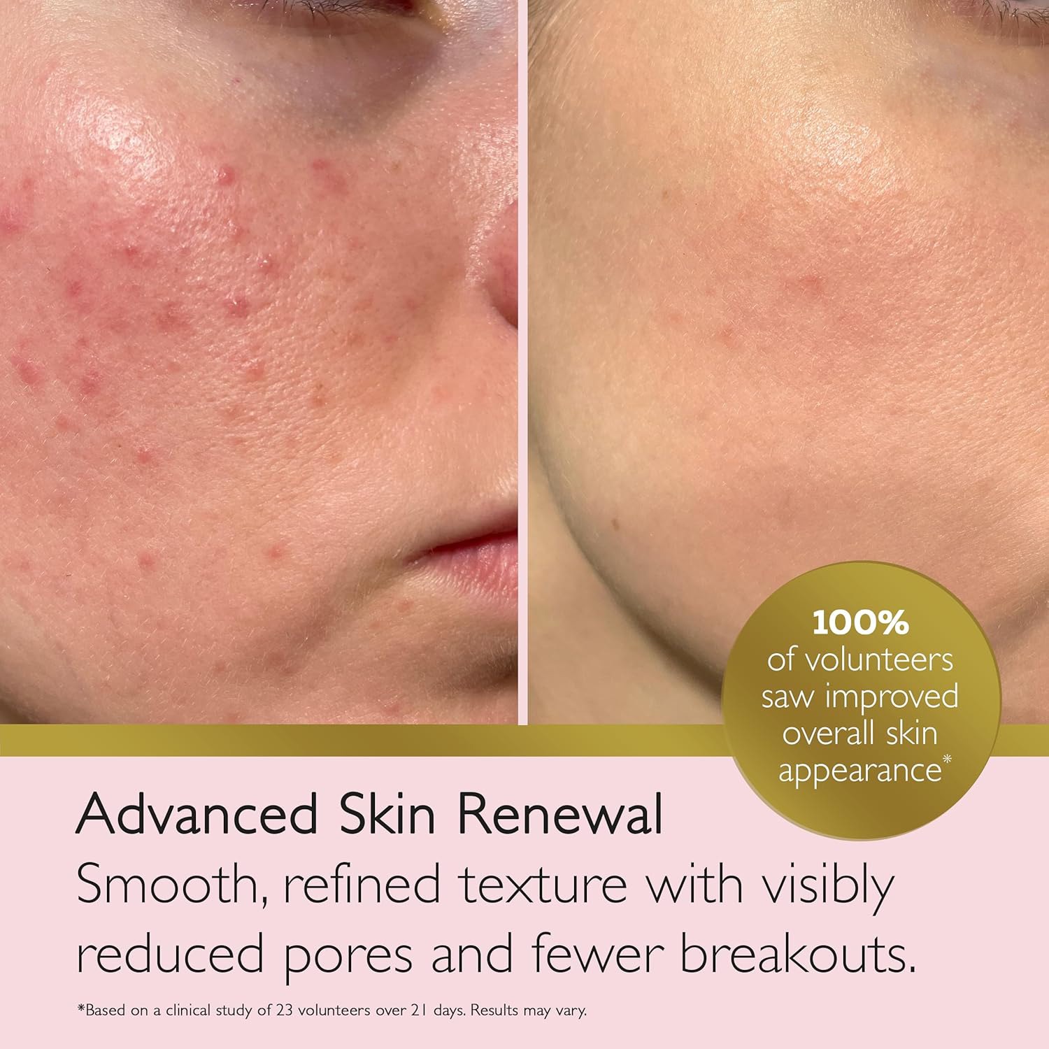 Spot Clear Blemish Control Gel - Image 8