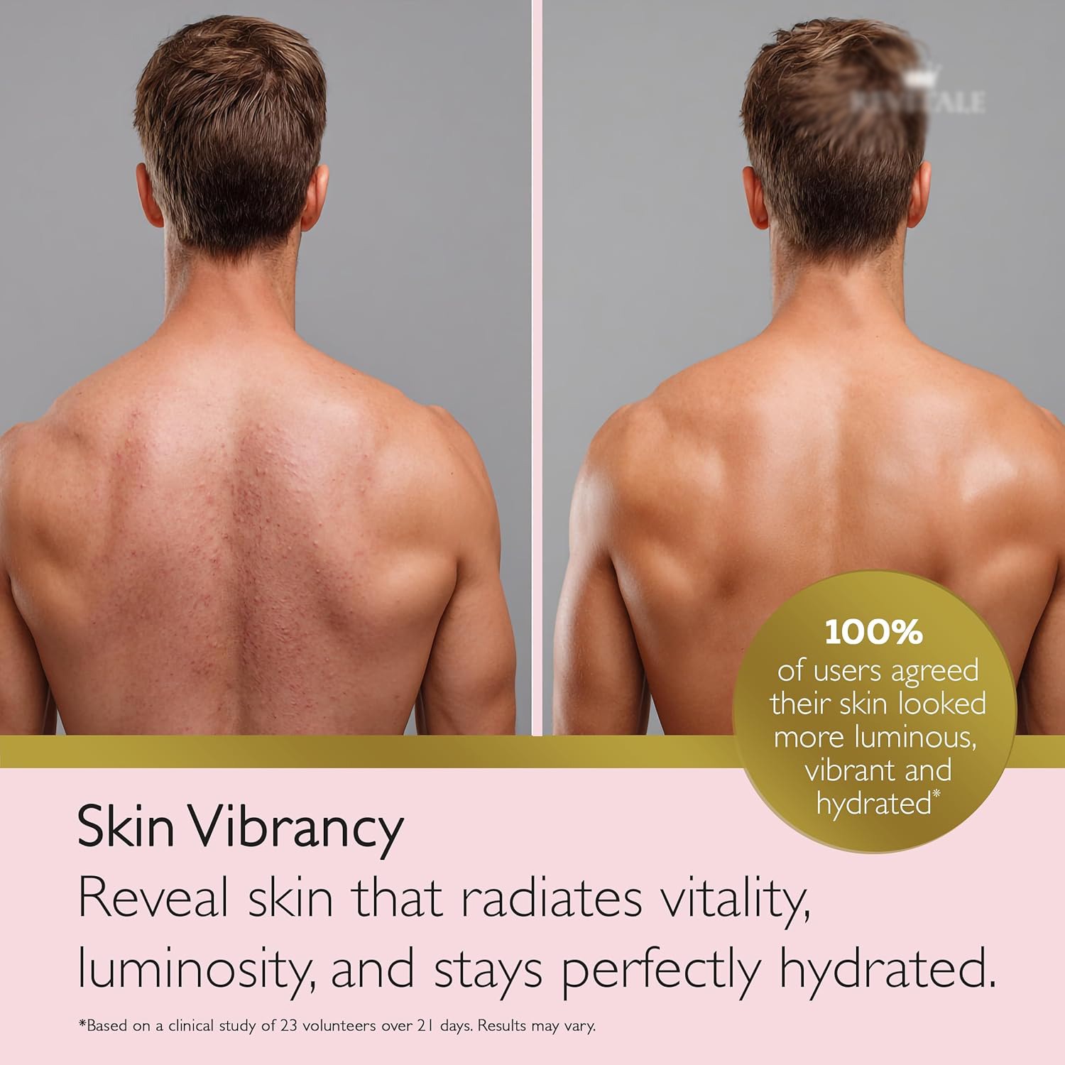 Spot Clear Blemish Control Gel - Image 6